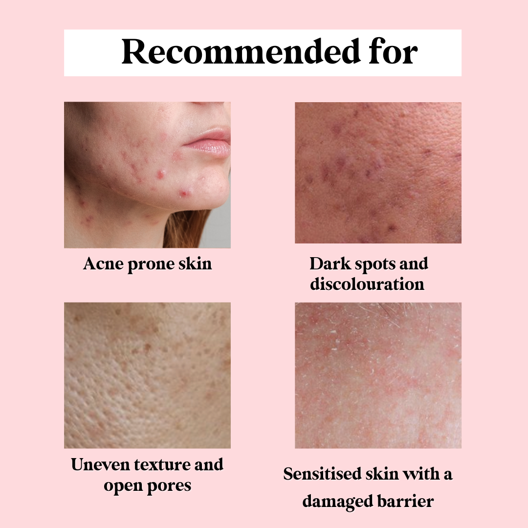 Better Niacinamide Serum Jelly 45ml