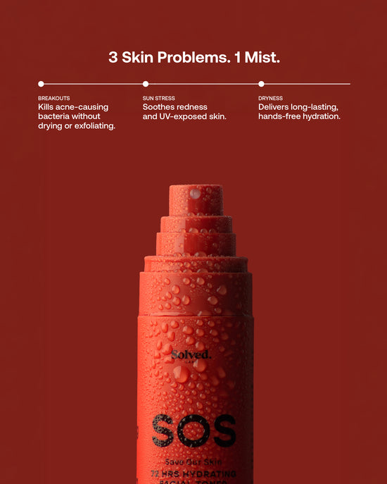 SOS